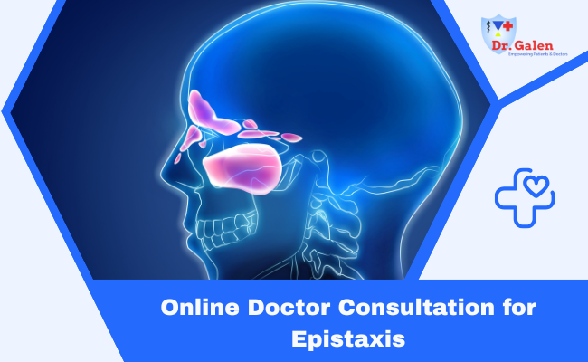 Online Doctor Consultation for Epistaxis