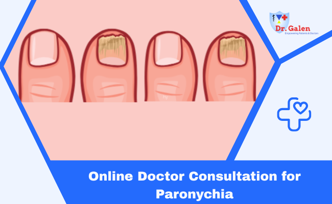 Online Doctor Consultation for Paronychia