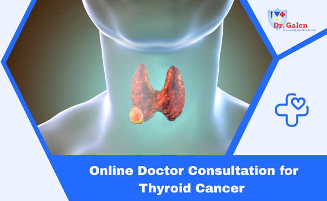 Online Doctor Consultation for Thyroid Cancer