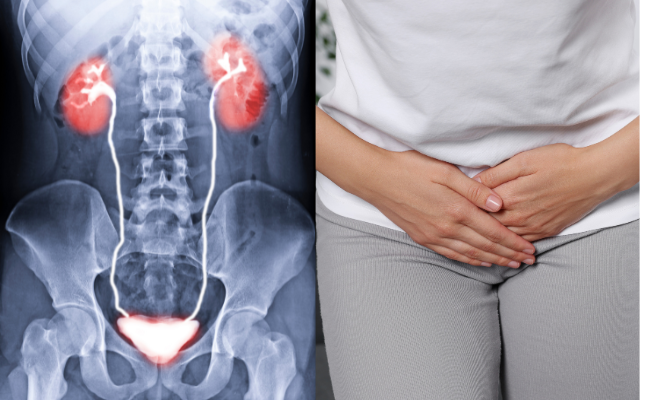 Urinary tract infections (UTI) during pregnancy