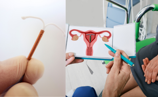 Concern: Displaced IUD, Delayed Appointment