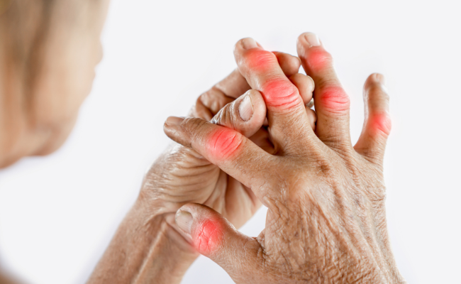 Alleviating Thumb Side Hand Pain: Remedies