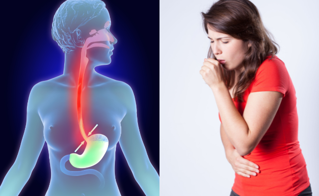 Persistent Cough - Diagnosis and Treatment