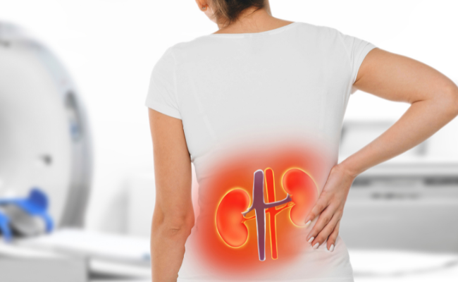 Remedies for Intense Kidney Stone Pain?