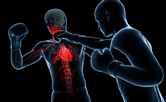 Boxing Match Injury: Chest Pain Relief?
