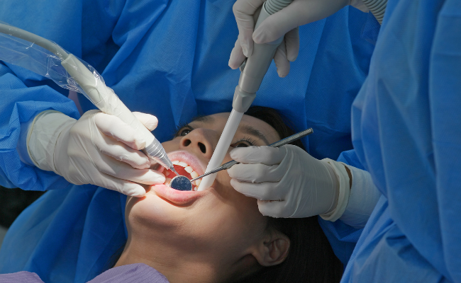 Preventing Cavities and Enamel Breakthrough