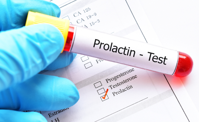 What Causes Low Prolactin Levels?