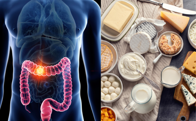 How do Dairy Products Impact Colon Cancer?
