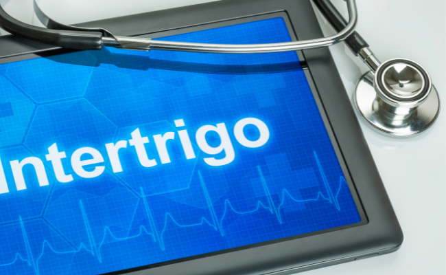 Intertrigo: What Is It, Causes, Symptoms & Treatment