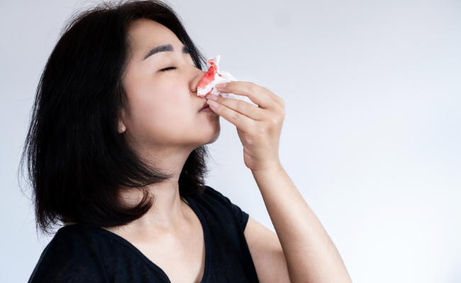 What's Causing Frequent Nosebleeds ?