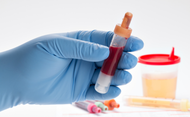 Could blood in urine indicate a UTI?