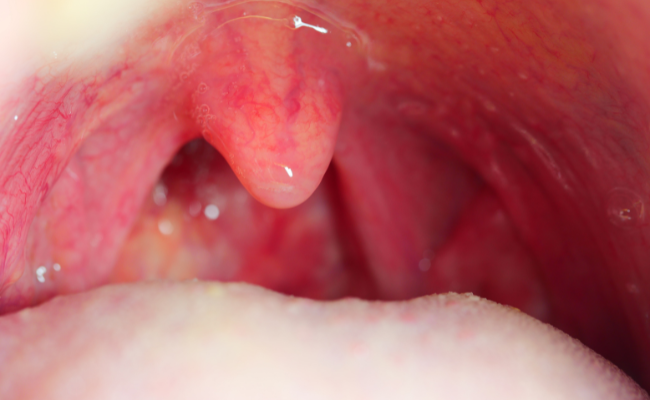 How can I manage throat pain and tonsil issues effectively?