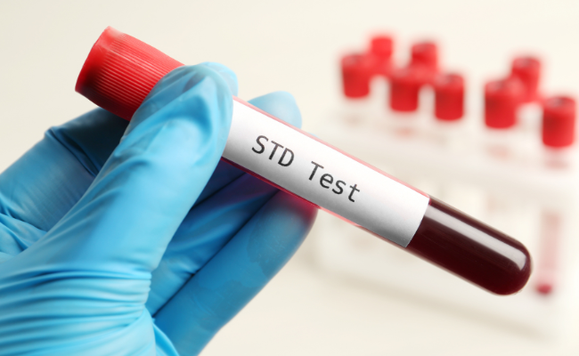 Why Did STI Test Results Differ?