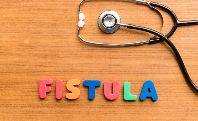 Fistula Treatment: Non-Surgical Options Explored