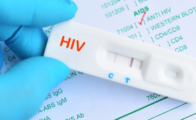 Expert Insights on HIV Test Results: Ease Your Concerns Now