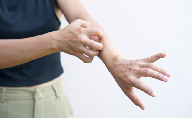 Concerned About Skin Infection Symptoms? Seek Expert Guidance