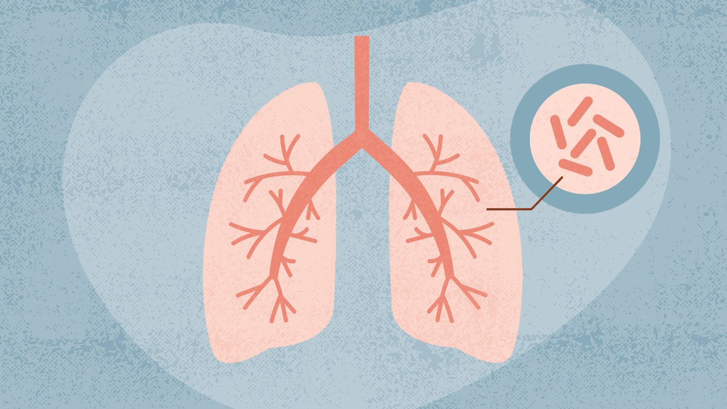 Insight into COPD: Symptoms, Causes, and Associated Risk Factors