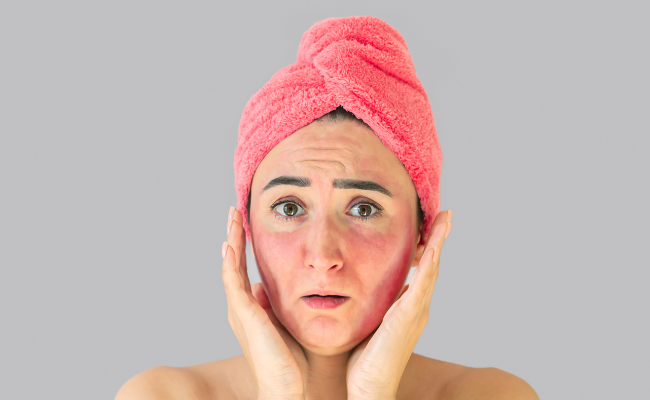 Dealing with Skin Irritation: Seek Expert Advice!