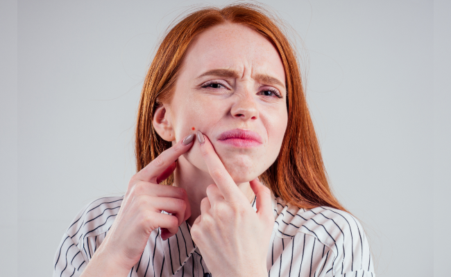 Expert Advice for Painful Pimple Below Your Mouth: Quick Relief Solution