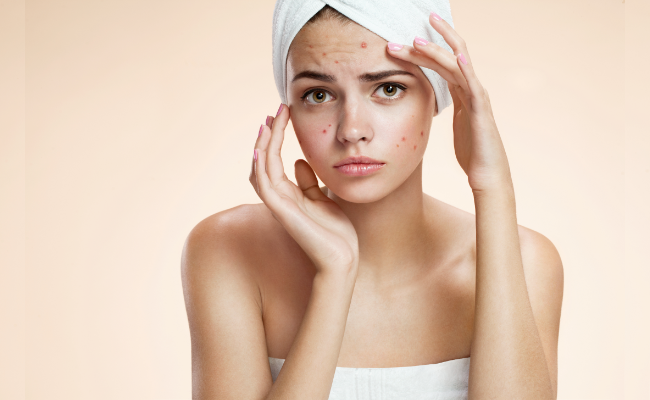 Get Rid of Acne and Dark Spots Quickly with Expert Advice