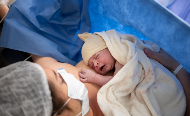 Get Relief from Back Pain After Your C-Section – Expert Treatment Awaits!