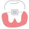 Dental Prosthetics